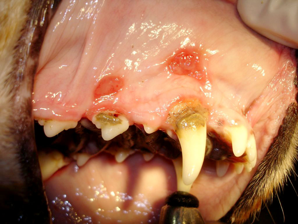 Bolestivé otlaky vnitřní strany pysku způsobené zubním kamenem