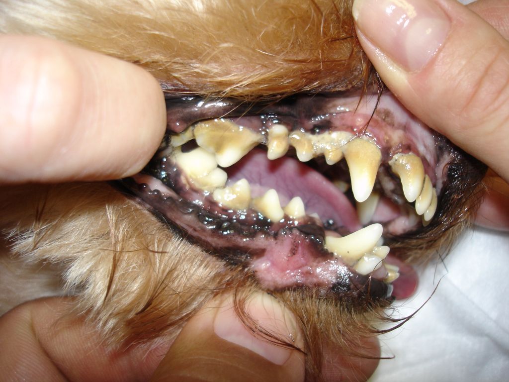 Silná vrstva zubního kamene